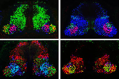 Spinal Cord Stained With Antibodies